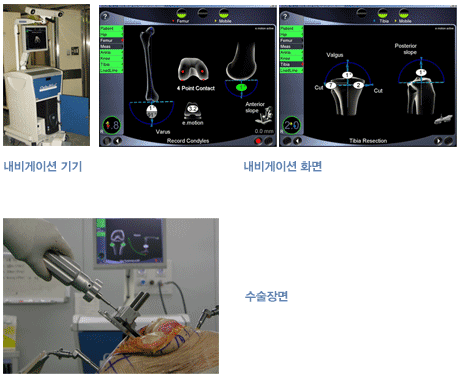 ������̼� ���� ȭ��, ������� ����