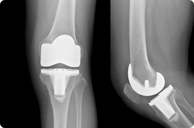 �ΰ����� �������� ����