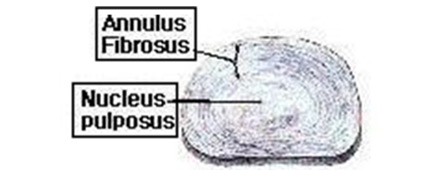 �߰��� or ��ũ (Disc)