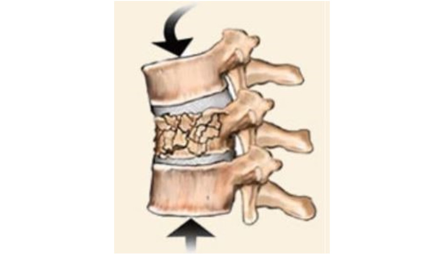 ô�� ����