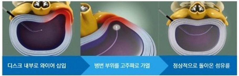 ������ ���ٰ��м�