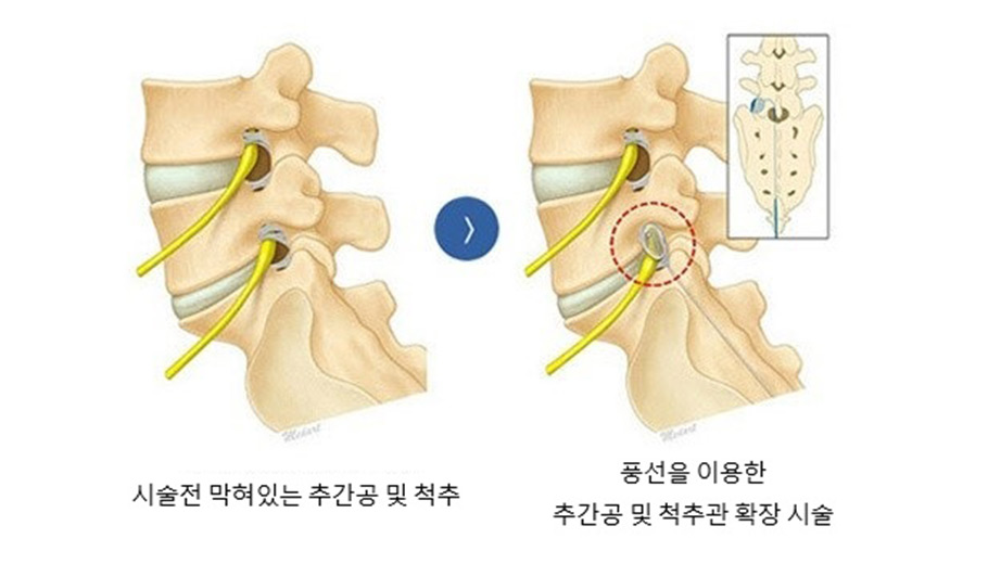 ǳ��Ȯ�� �Ű漺����