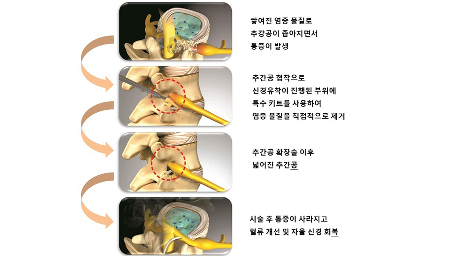 �߰��� Ȯ���