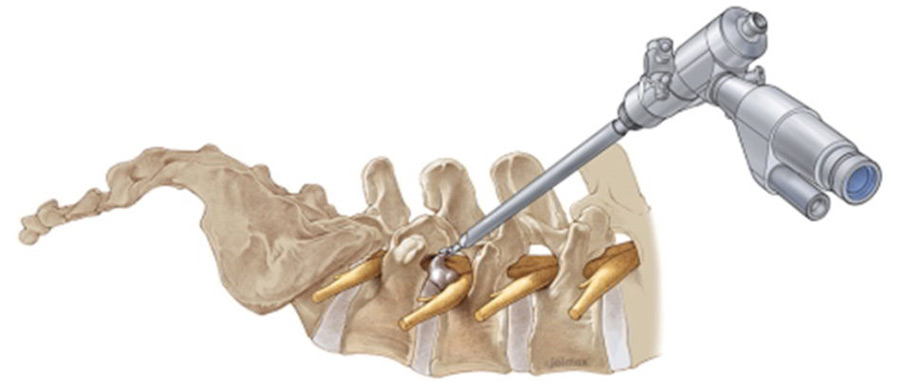 ���ð��� ���ٰ��м�, ���ð��� �Ű氨�м�(�ܹ��� ���ð��)