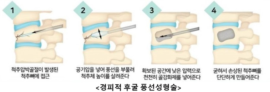 ������ ô�� �ı�ǳ��������